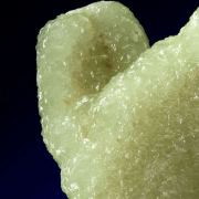 Prehnite Cast After Anhydrite