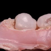 Opal (Pink and Lavender)