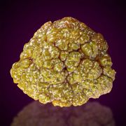 Pyromorphite 